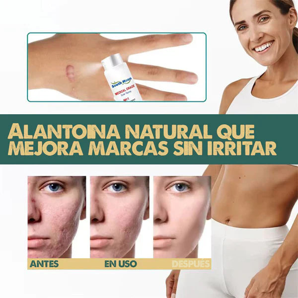 South Moon™ Spray para las Cicatrices y Queloides
