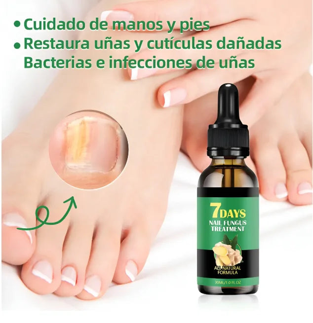 Nail Fungus™ Gotas para Hongos de Uñas Tratamiento de 7 días
