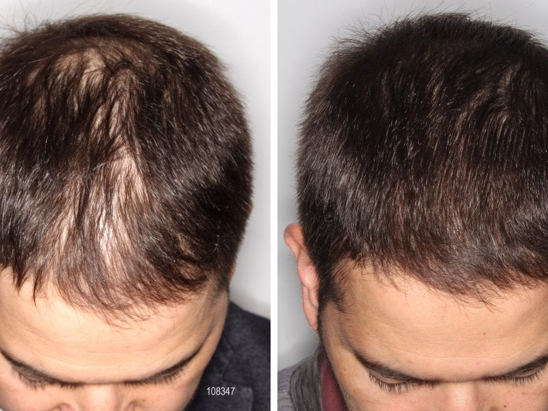 BatanaLux™ Aceite de batana estimula el crecimiento natural de tu cabello