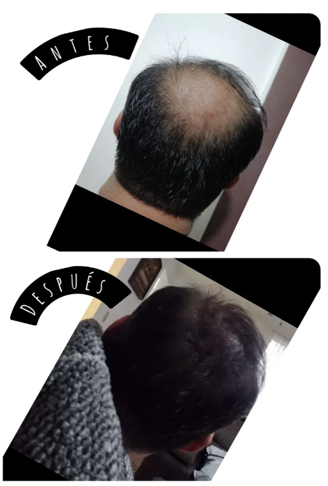 Fibras Capilares Duraderas e Instantáneas DexerHair 2x1