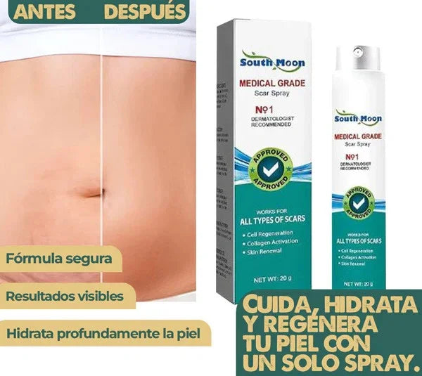 South Moon™ Spray para las Cicatrices y Queloides