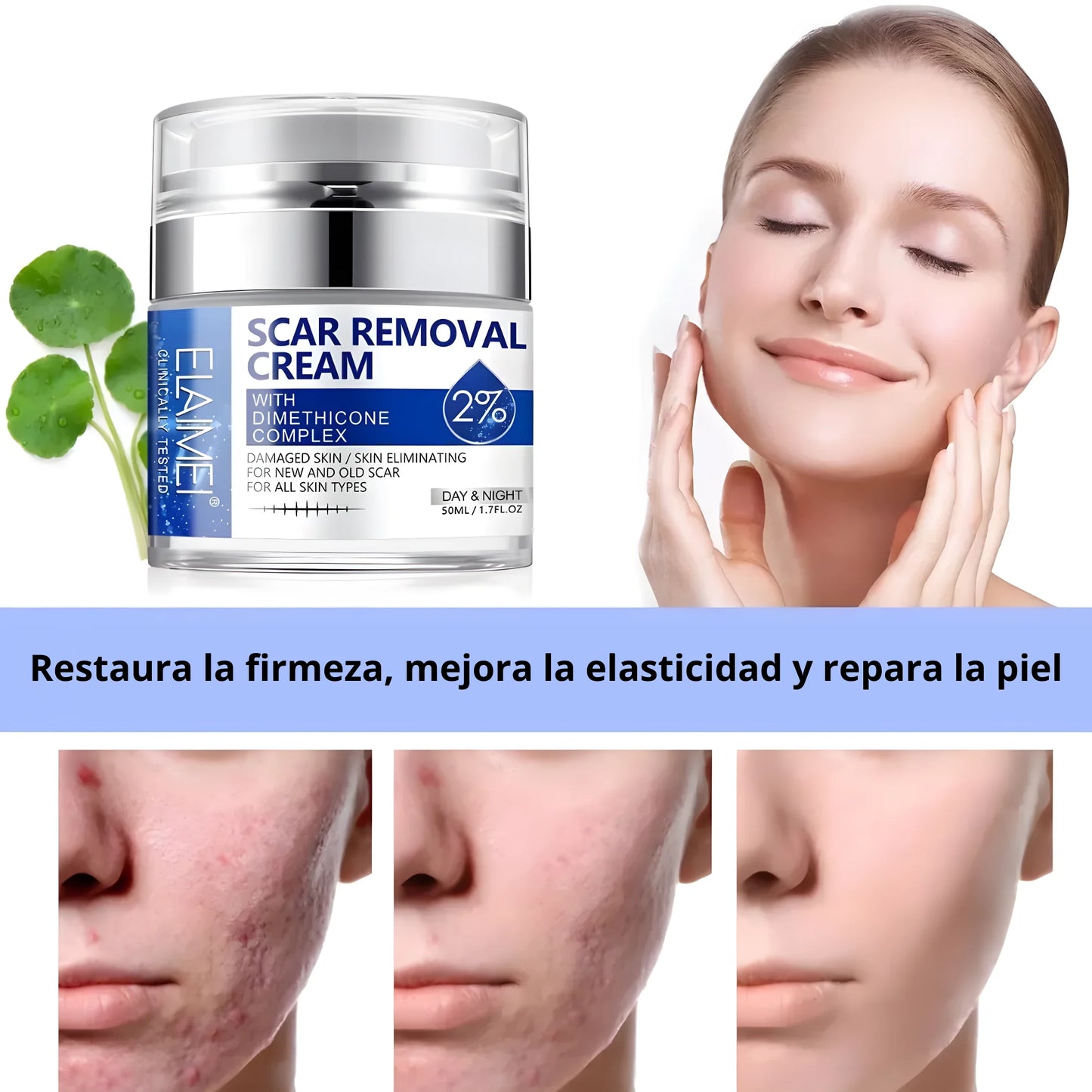 Scar Removal™ Crema Para Cicatrices Profundas