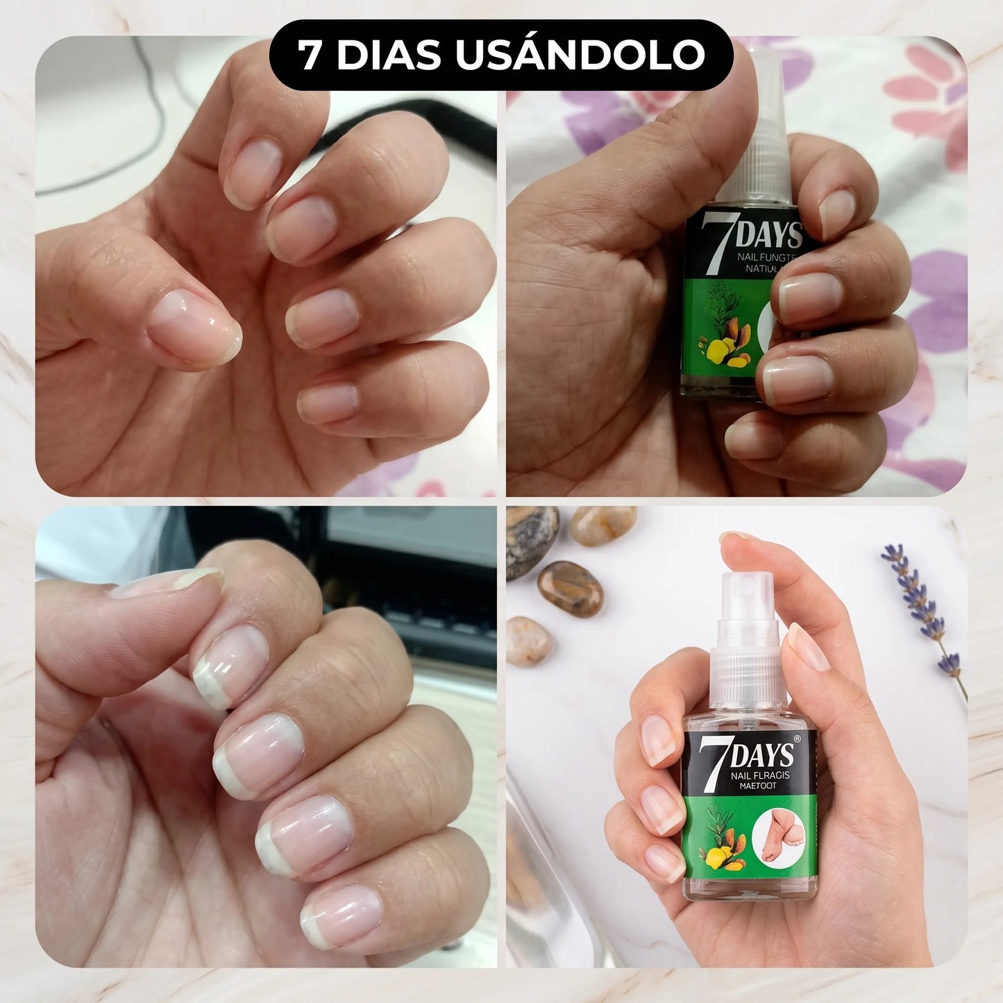 Nailux™ Serum Reparador y Crecimiento de Uñas ¡2x1!