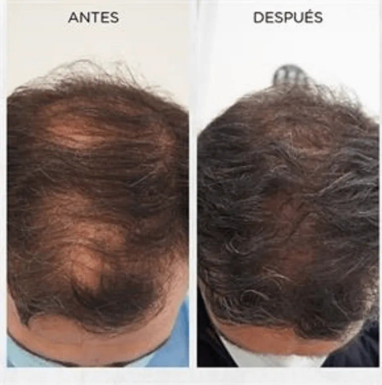 BatanaLux™ Aceite de batana estimula el crecimiento natural de tu cabello